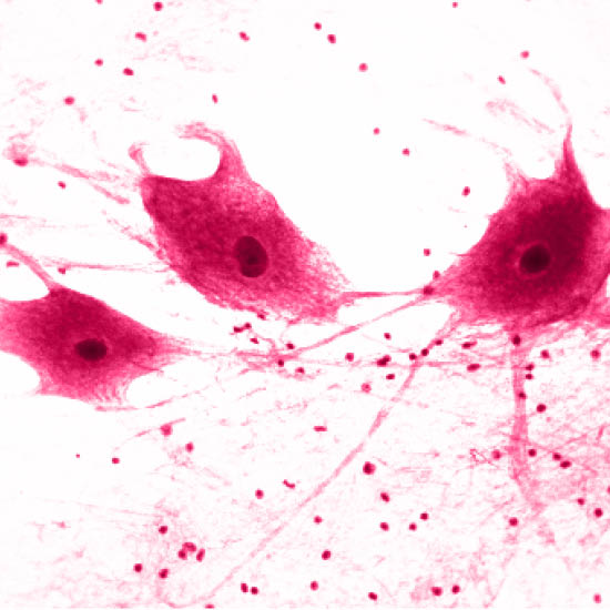 Encefalitis