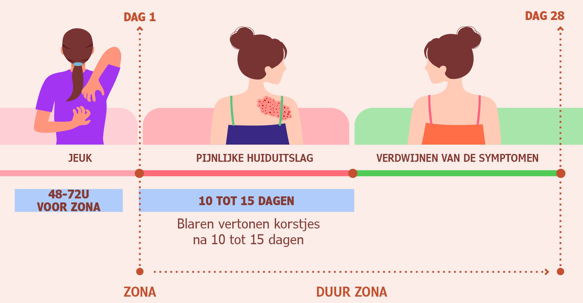 Drie afbeeldingen die de stadia van zona laten zien. Eerste: de vrouw krabt aan haar rechterschouder. Tweede: vrouw met rode, blaarvormige uitslag op de schouder. Derde: vrouw met heldere huid op de schouder.